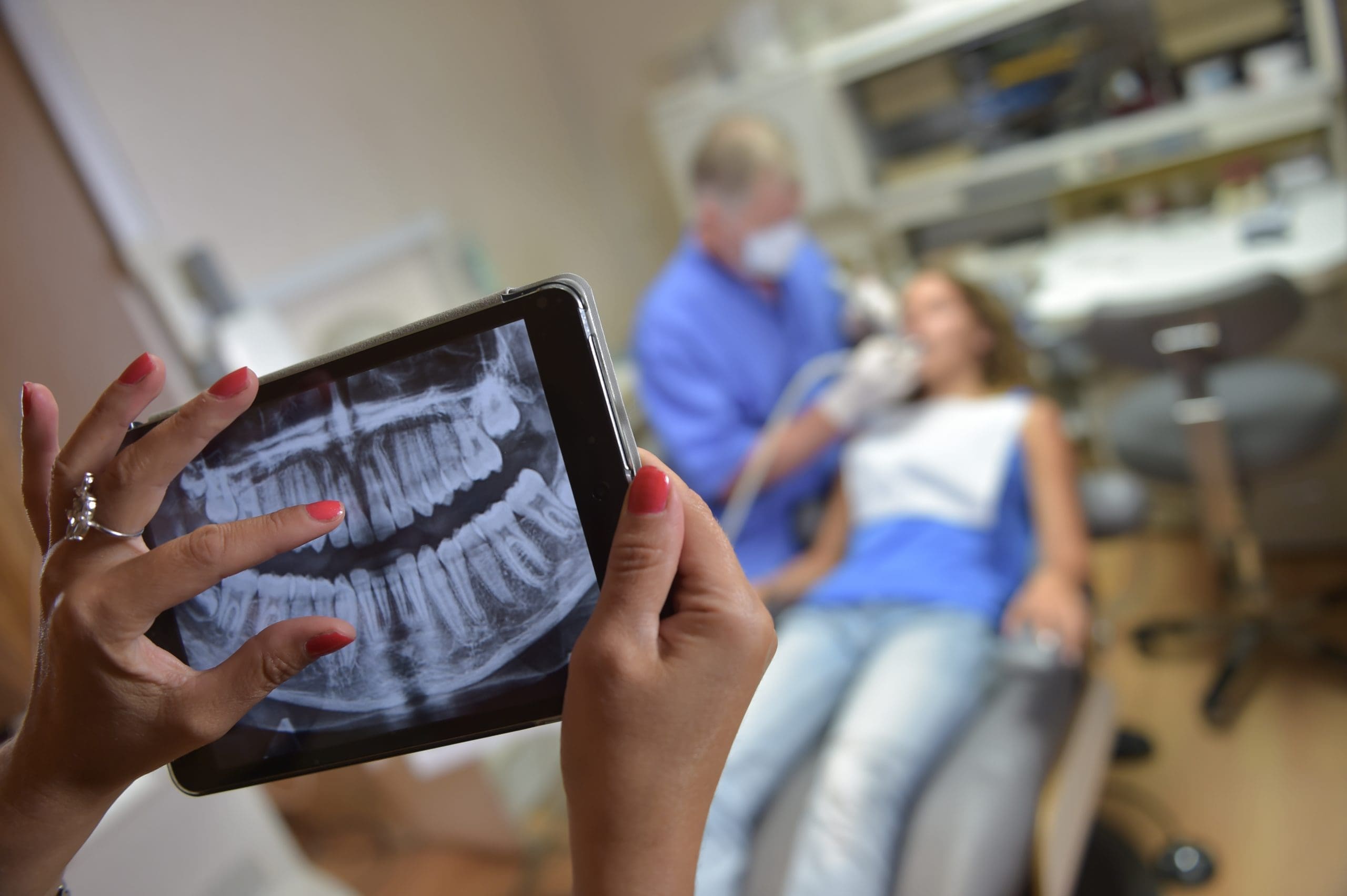 Benefits of Digital X-Rays for Your Dental Health